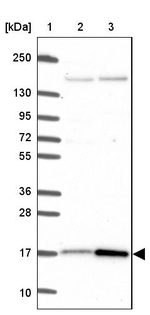 CUTA Antibody in Western Blot (WB)