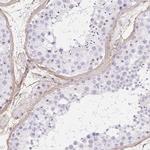 PDZD2 Polyclonal Antibody