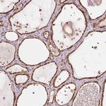 ARHGAP6 Polyclonal Antibody