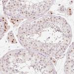 ARHGAP22 Polyclonal Antibody