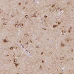 SEZ6L2 Antibody in Immunohistochemistry (Paraffin) (IHC (P))