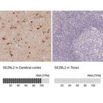 SEZ6L2 Antibody in Immunohistochemistry (IHC)