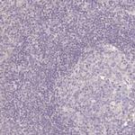 SEZ6L2 Antibody in Immunohistochemistry (IHC)