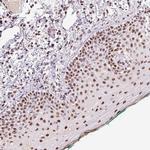 DPPA5 Polyclonal Antibody