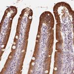 TMSB15B Polyclonal Antibody