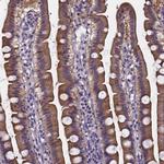 SOWAHA Polyclonal Antibody