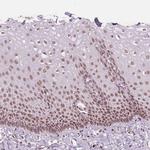 DPM2 Polyclonal Antibody