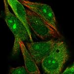 GYG2 Polyclonal Antibody