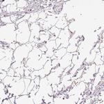 GYG2 Antibody in Immunohistochemistry (Paraffin) (IHC (P))