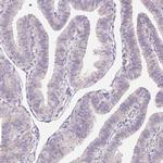 GYG2 Antibody in Immunohistochemistry (Paraffin) (IHC (P))