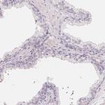 GYG2 Antibody in Immunohistochemistry (Paraffin) (IHC (P))