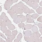 GYG2 Antibody in Immunohistochemistry (Paraffin) (IHC (P))