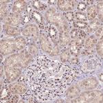ZBTB4 Antibody in Immunohistochemistry (Paraffin) (IHC (P))