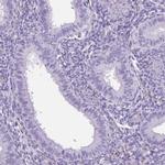 SHCBP1L Antibody in Immunohistochemistry (IHC)