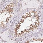 SHCBP1L Antibody in Immunohistochemistry (IHC)
