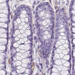 SHCBP1L Antibody in Immunohistochemistry (IHC)