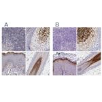 GSDMA Antibody in Immunohistochemistry (IHC)