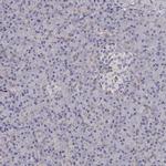 GSDMA Antibody in Immunohistochemistry (IHC)
