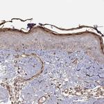GSDMA Antibody in Immunohistochemistry (IHC)