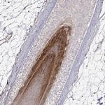 GSDMA Antibody in Immunohistochemistry (IHC)