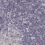 GSDMA Antibody in Immunohistochemistry (IHC)