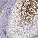 GSDMA Antibody in Immunohistochemistry (IHC)