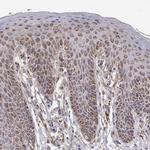 SPICE1 Antibody in Immunohistochemistry (Paraffin) (IHC (P))