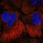 SPICE1 Polyclonal Antibody