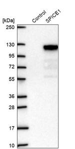 SPICE1 Antibody in Western Blot (WB)