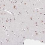 CA150 Antibody in Immunohistochemistry (IHC)