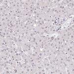 CA150 Antibody in Immunohistochemistry (IHC)
