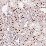 RTP4 Antibody in Immunohistochemistry (Paraffin) (IHC (P))