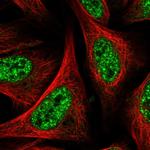 CARKL Polyclonal Antibody