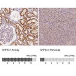CARKL Antibody in Immunohistochemistry (IHC)