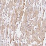BATF Antibody in Immunohistochemistry (Paraffin) (IHC (P))
