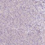 BATF Antibody in Immunohistochemistry (Paraffin) (IHC (P))