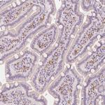 BATF Antibody in Immunohistochemistry (Paraffin) (IHC (P))