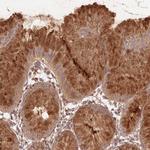 STARD7 Polyclonal Antibody