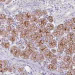Aquaporin 5 Antibody in Immunohistochemistry (Paraffin) (IHC (P))