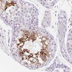 Aquaporin 5 Antibody in Immunohistochemistry (Paraffin) (IHC (P))