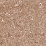 RIC3 Antibody in Immunohistochemistry (Paraffin) (IHC (P))