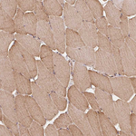 RIC3 Antibody in Immunohistochemistry (Paraffin) (IHC (P))