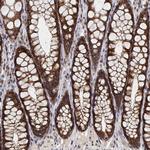 GADD45GIP1 Polyclonal Antibody