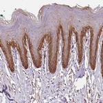 TMEM253 Polyclonal Antibody