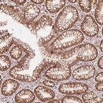 URM1 Polyclonal Antibody