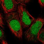 DDX11 Polyclonal Antibody