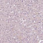 DDX11 Antibody in Immunohistochemistry (Paraffin) (IHC (P))