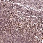 DDX11 Antibody in Immunohistochemistry (Paraffin) (IHC (P))
