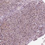 DDX11 Antibody in Immunohistochemistry (Paraffin) (IHC (P))