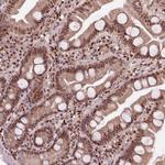 DDX11 Antibody in Immunohistochemistry (Paraffin) (IHC (P))